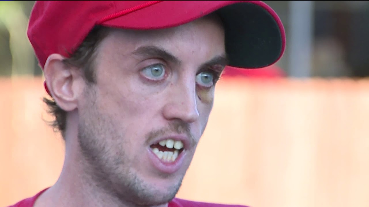 Man says he was attacked because of "Make America Great Again` hat